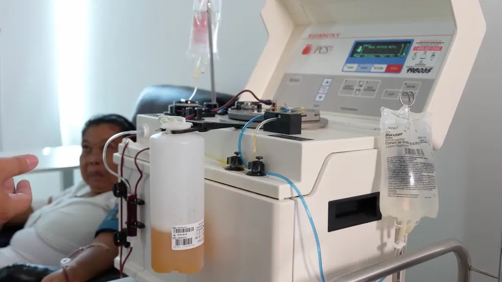 An apheresis procedure in progress, with the separation device and collection bag in view.